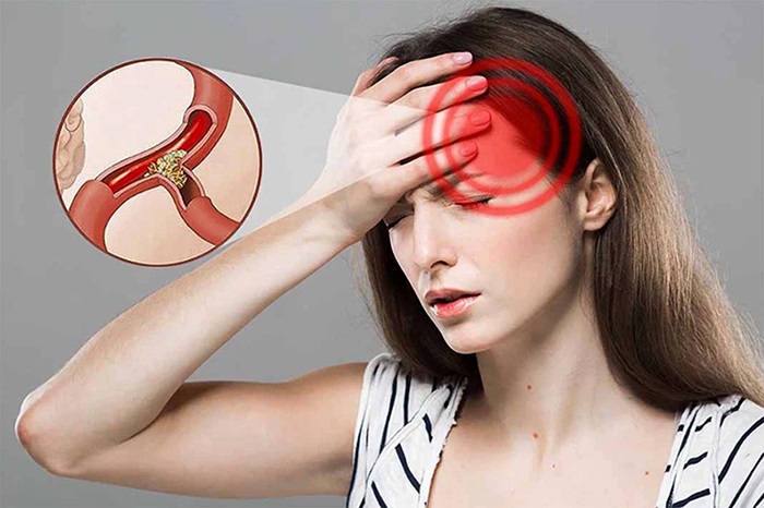 Hé lộ 5 dấu hiệu thiếu máu não ở người trẻ tuổi