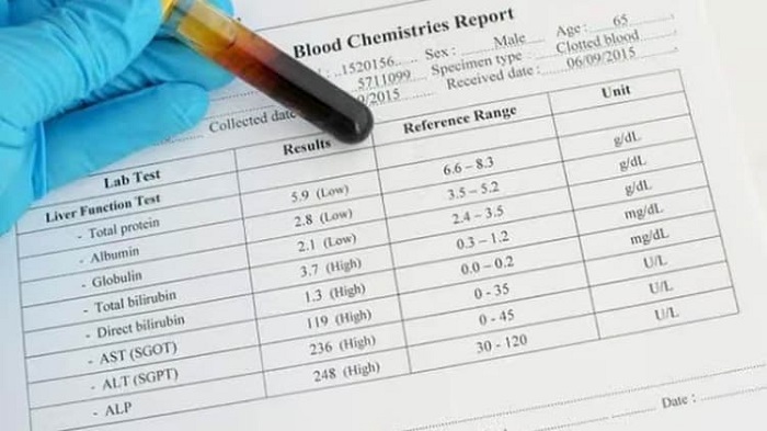 sgpt-trong-xet-nghiem-mau-la-gi-1